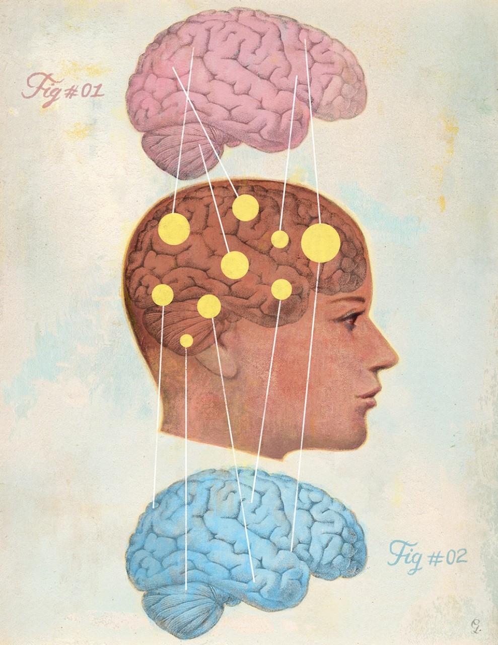 How men's and women's brains are different | Stanford Medicine