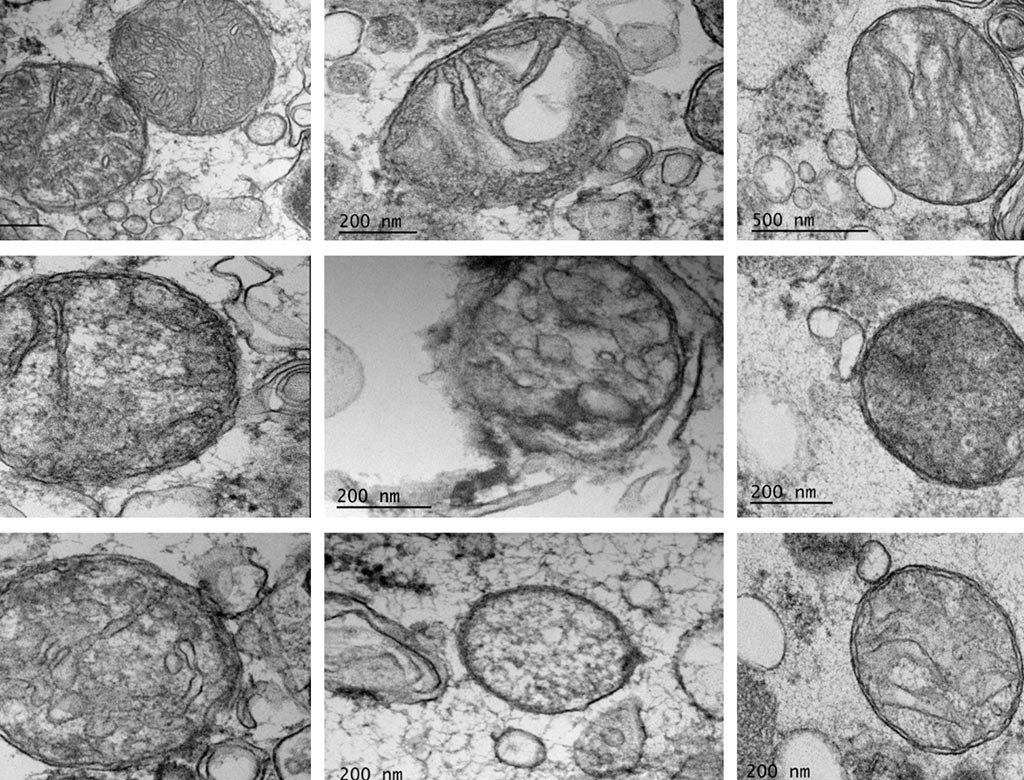 Images of mitochondria cells in various stages of health