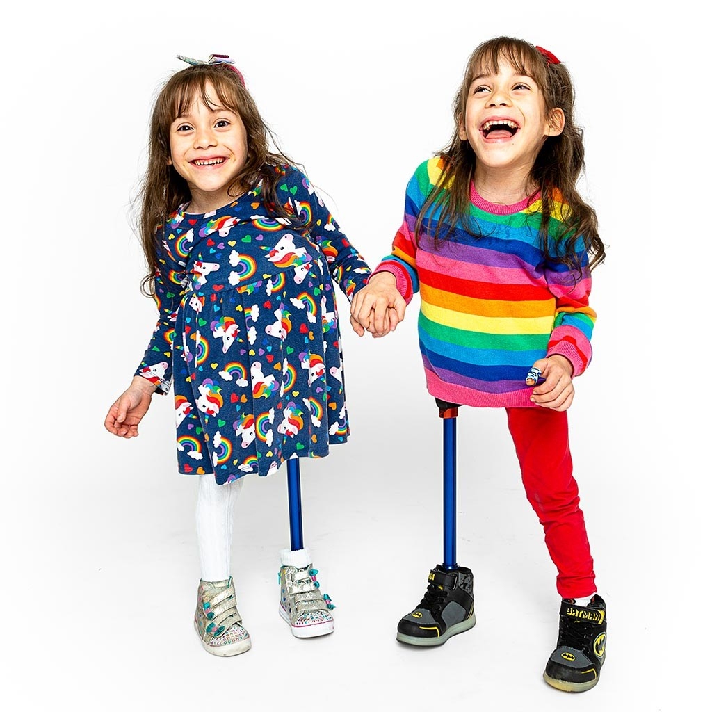 Formerly conjoined twin girls are flourishing | Stanford Medicine