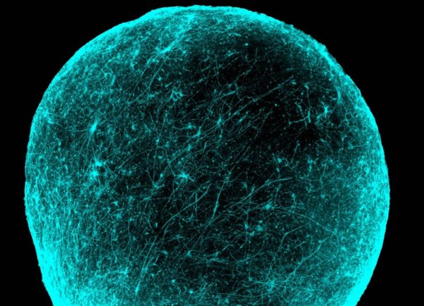 Brain ball image from the lab of Sergiu Pasca