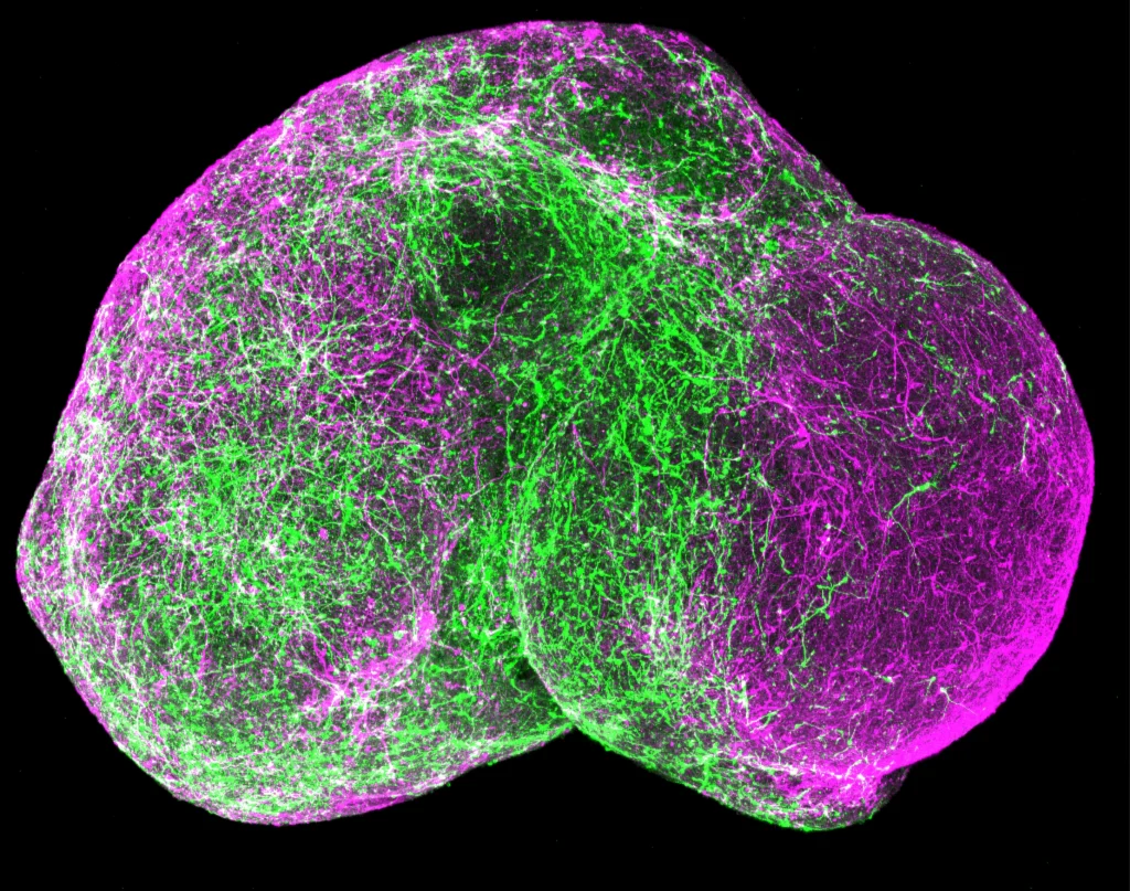 Cover for Considering assembloids and organoids