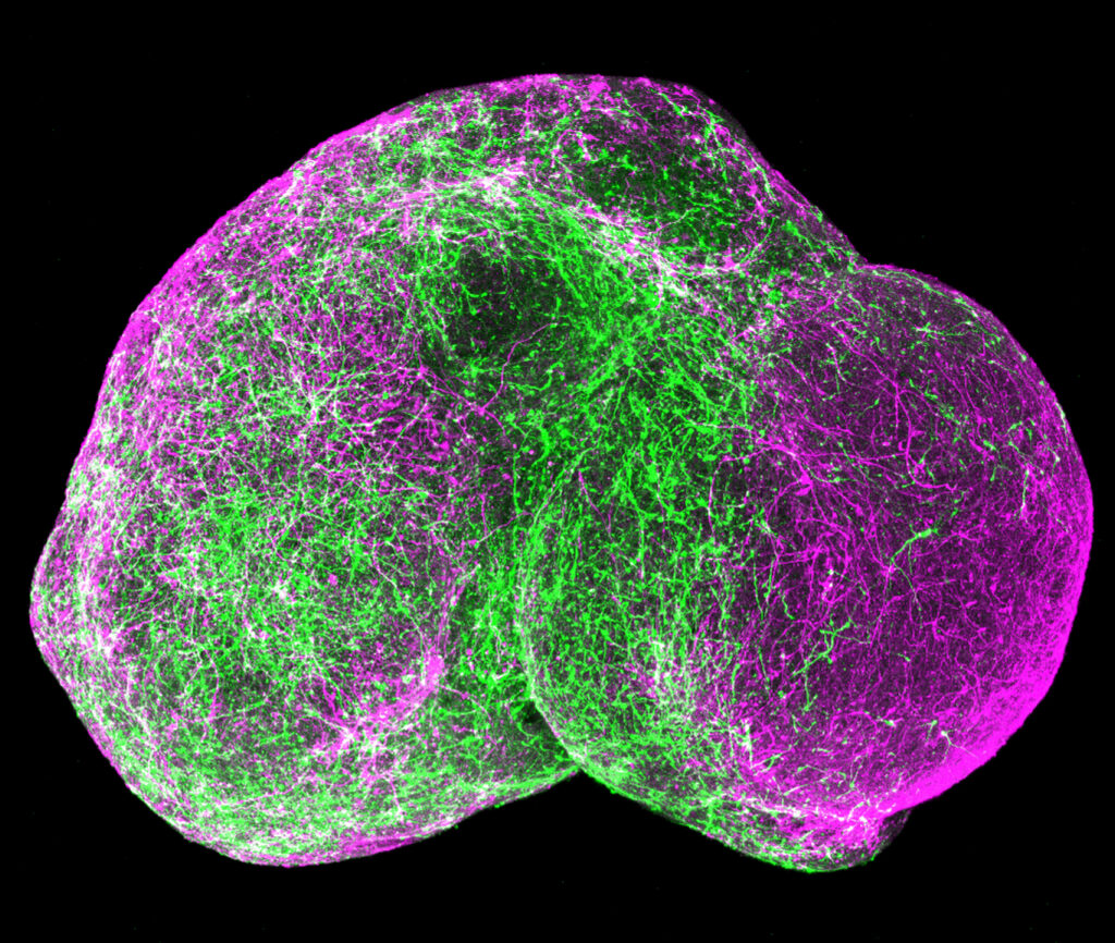 Cover for Considering assembloids and organoids