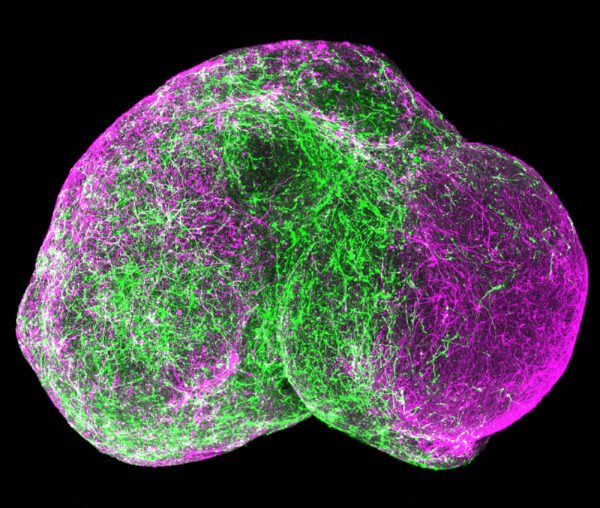 Cover for Considering assembloids and organoids