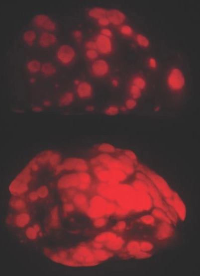 Images of young and old lungs