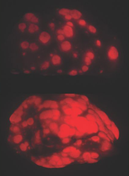 Cover for How aging might lower cancer risk