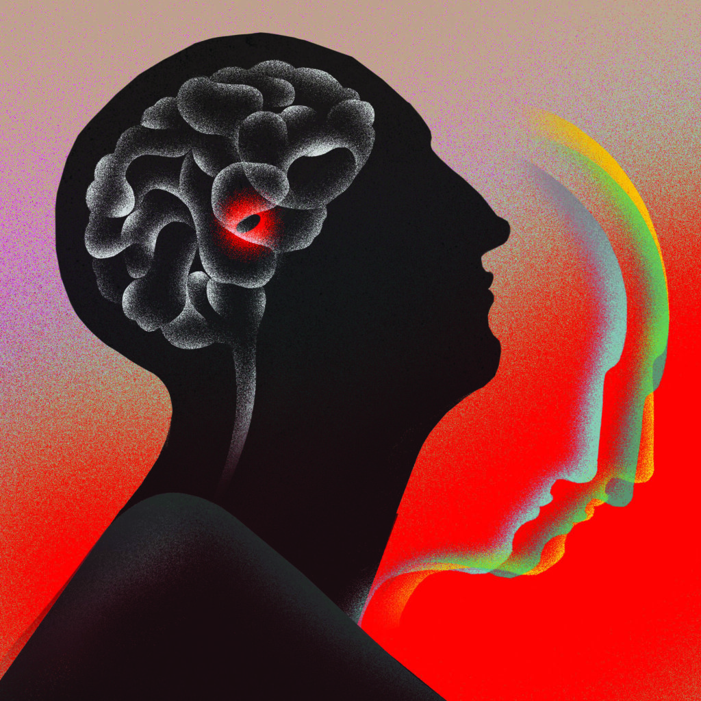 Cover for A pacemaker for the brain