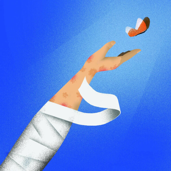 Cover for Gene therapy for epidermolysis bullosa