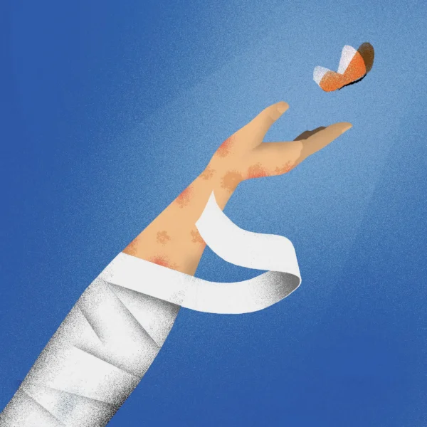 Illustration by Brian Stauffer for story gene therapy for epidermolysis bullosa