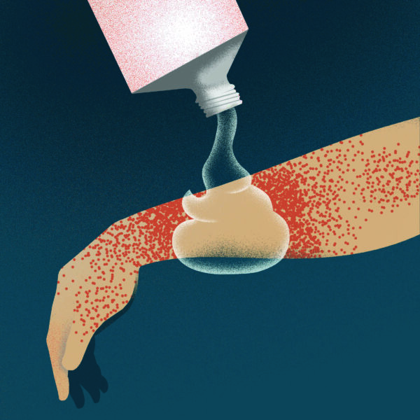 Cover for An ointment to quell atopic dermatitis