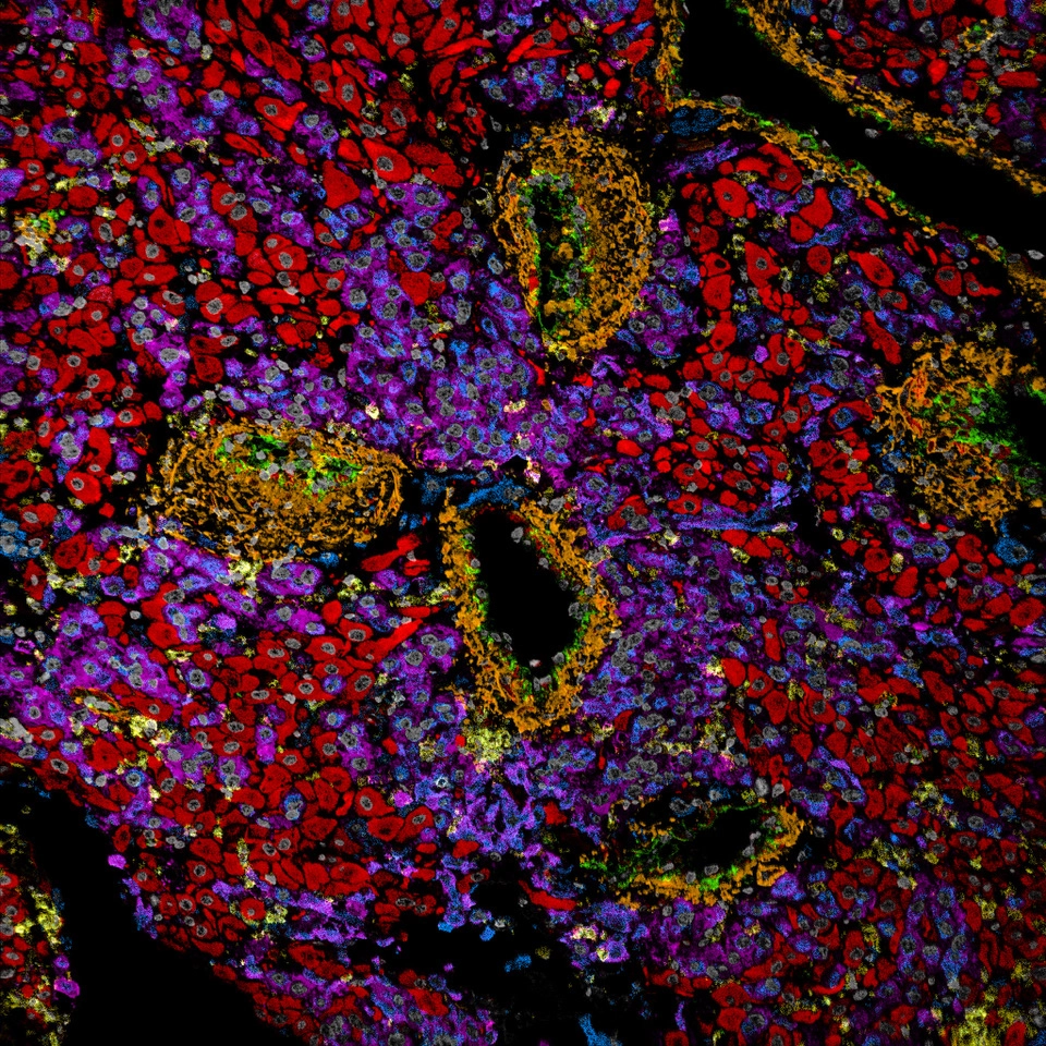 Trophoblasts (purple) have invaded the mother’s endometrium and surrounded arteries, which they will eventually enter and transform into large vessels.