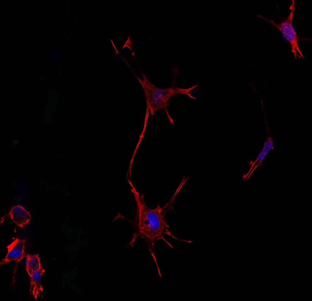 An activated fibroblast in culture.