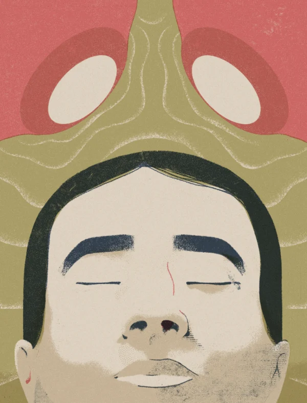 Illustration of someone undergoing interventional therapy