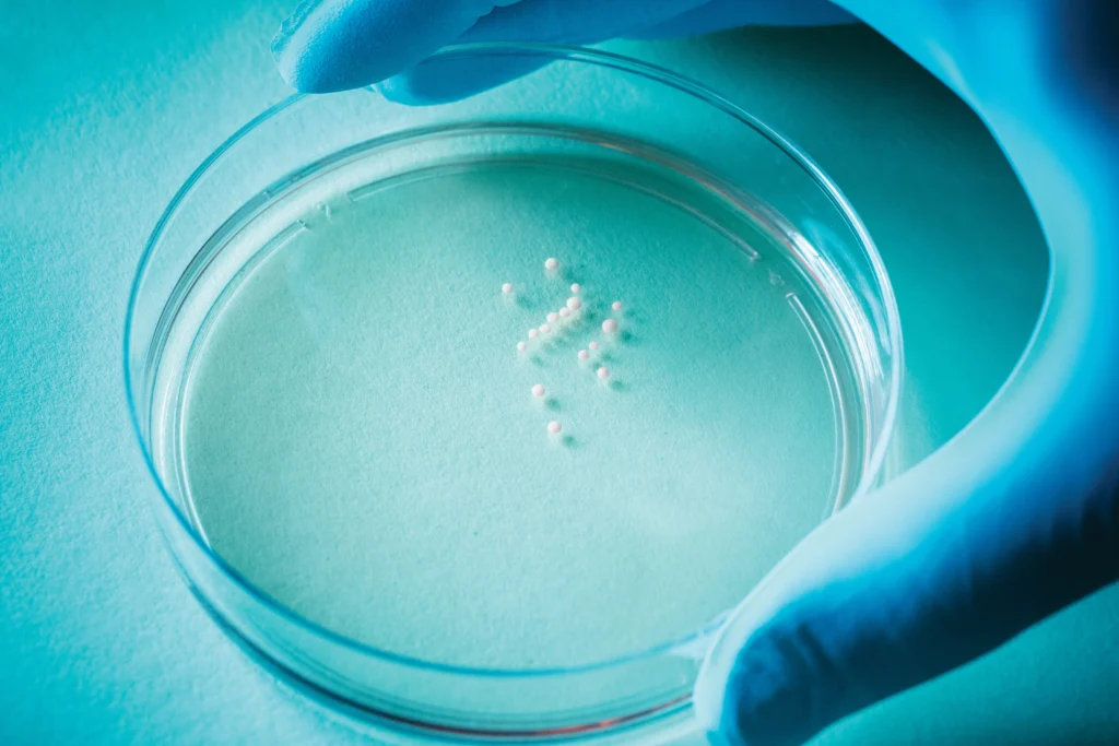 Photo of organoids in the lab of Sergiu Pasca, MD, the Kenneth T. Norris, Jr. Professor II of Psychiatry and Behavioral Sciences.