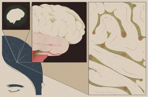 Collage illustration for a story about precision psychiatric care.