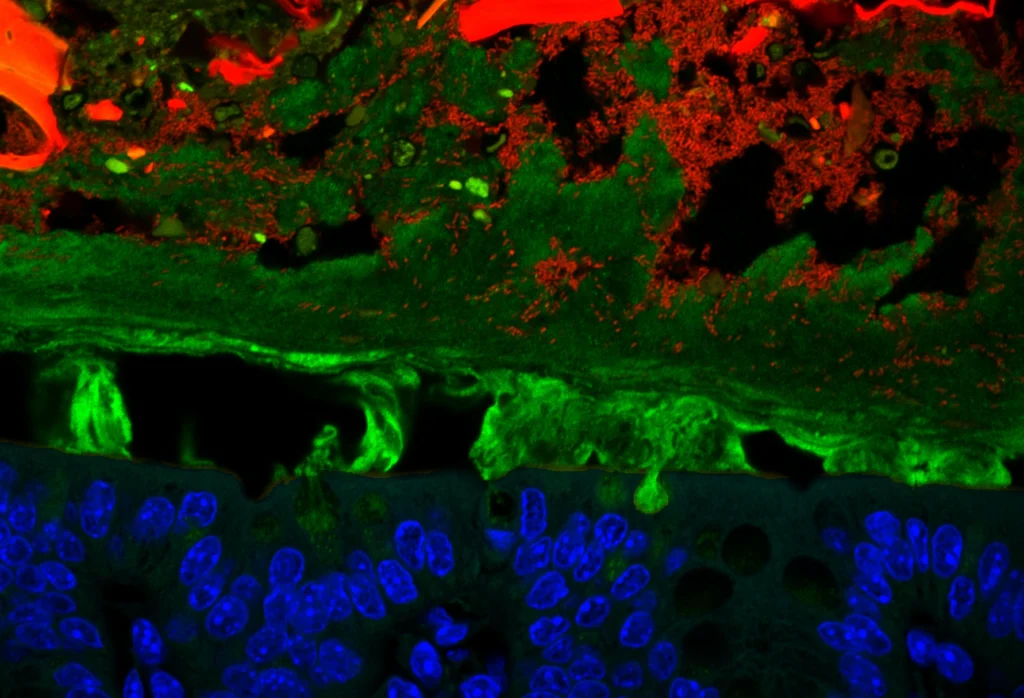 Bacteroides thetaiotaomicron (red) roams the gut, where it digests fiber.