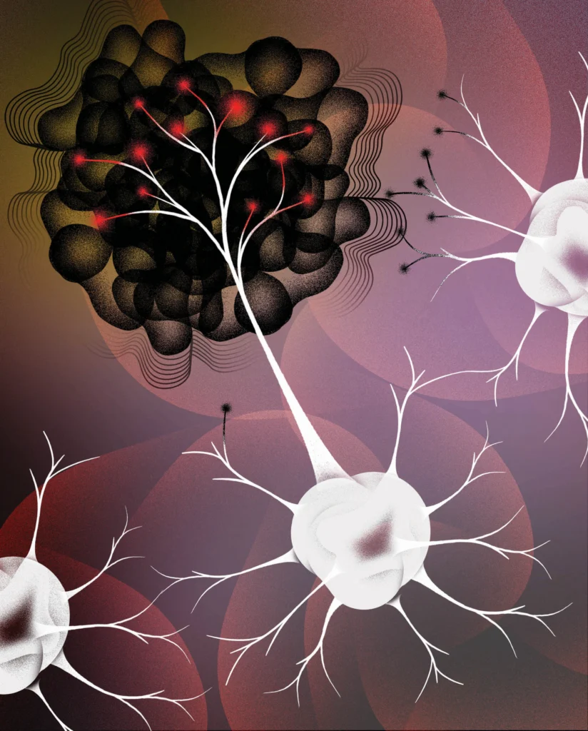 Illustration depicting neurons and cancer cells