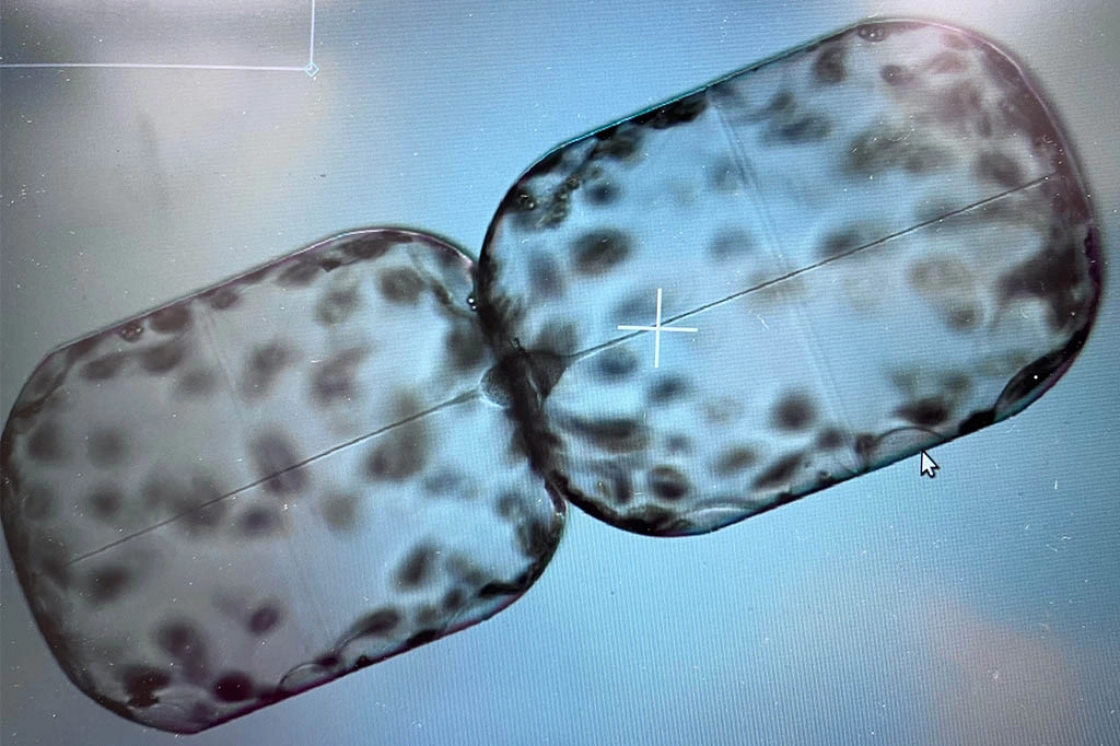 A dividing diatom, genus Ethmodiscus, collected from surface waters close to Bermuda.