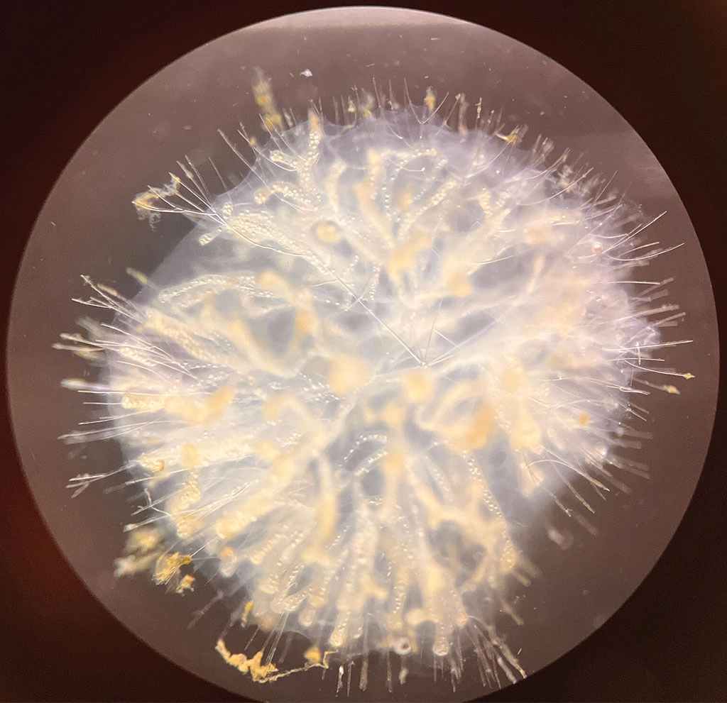 A rare radiolarian, collected in June 2024 from the deep sea, California Current, Pacific Ocean.