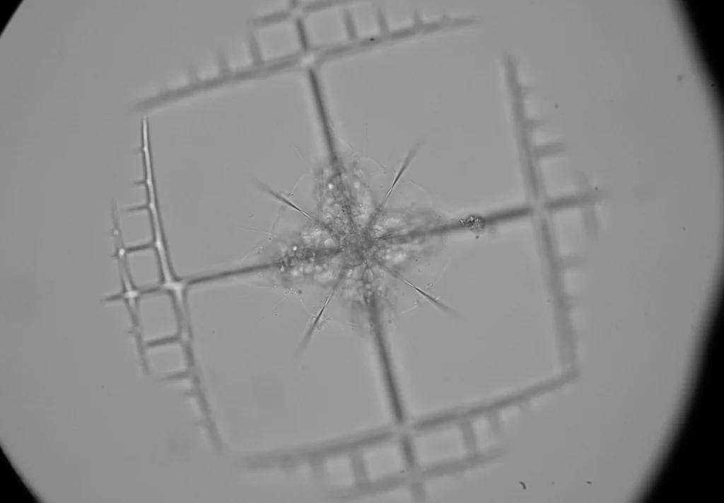 An acantharian cell, genus Lithoptera, collected near Villefranche, France, and Naples, Italy.