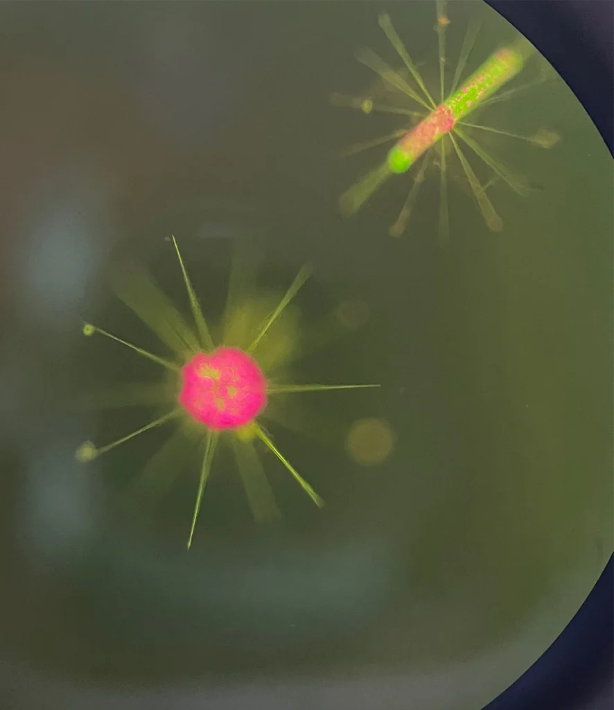 Fluorescent acantharian cell collected near Villefranche, France, and Naples, Italy. Photo by Manu Prakash, Prakash Lab