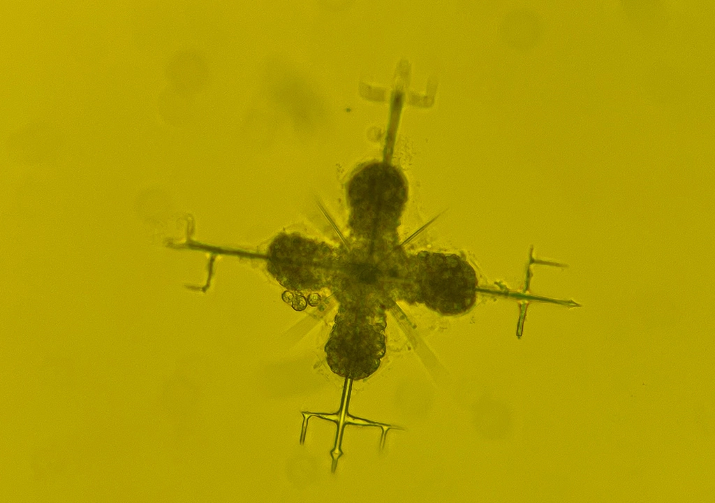 An acantharian cell, genus Lithoptera, collected near Villefranche, France, and Naples, Italy.