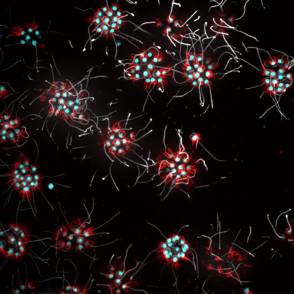 Colonies of choanoflagellates, the closest single-celled relatives to animals.