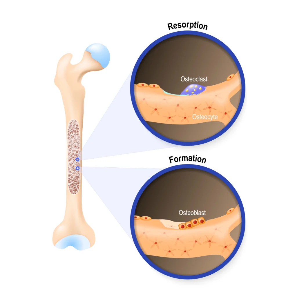 Illustration of bone remodeling