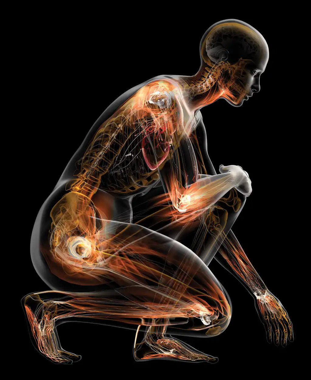 An X-ray illustration of a person crouching