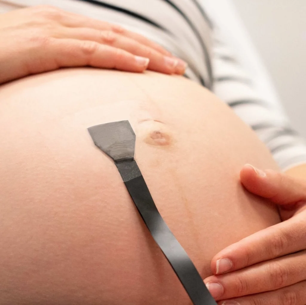 Woman with a fetal monitoring patch on her belly